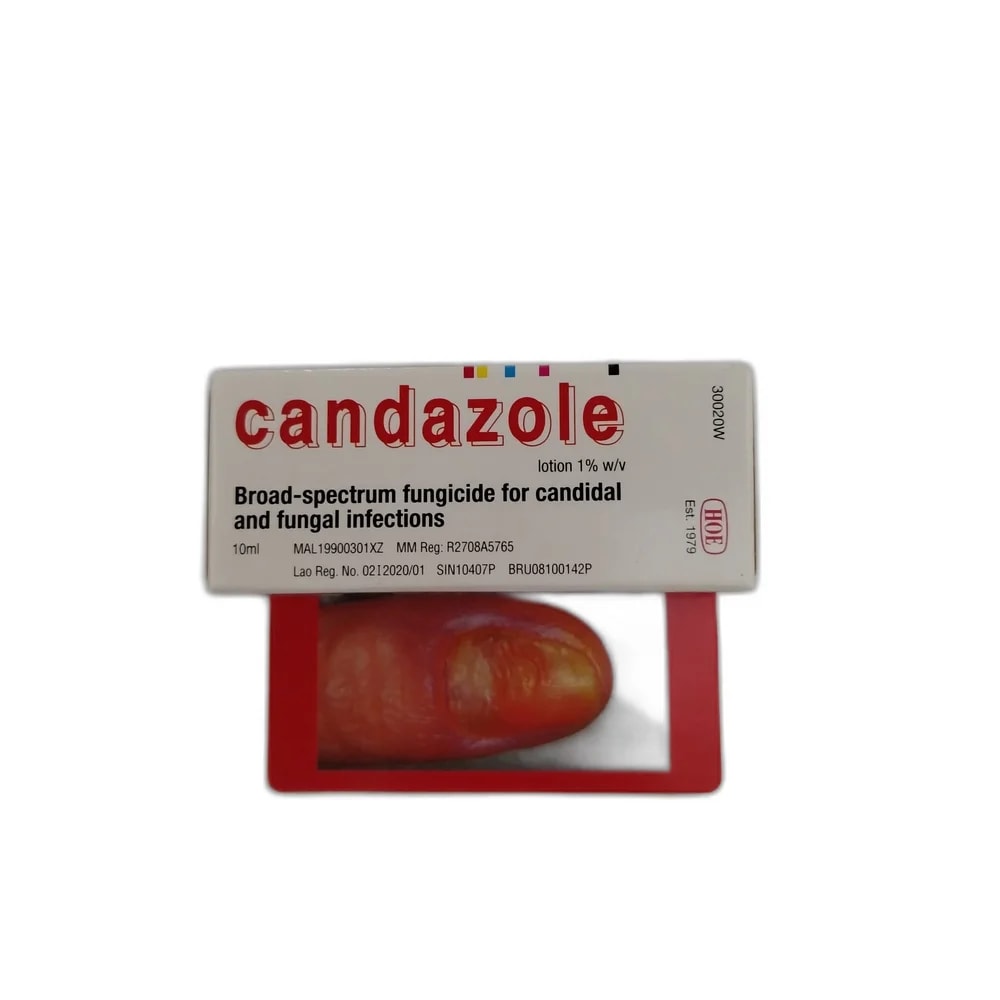 Candazole 1% - DHOU CARE PHARMACY
